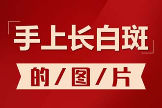 怎么看白斑是不是就是白癜风呢